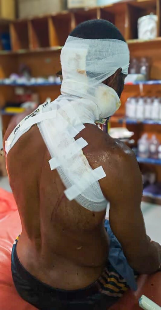 At Kundiawa A&E, John got his stab wounds treated (credit: Andrew Yalbai)