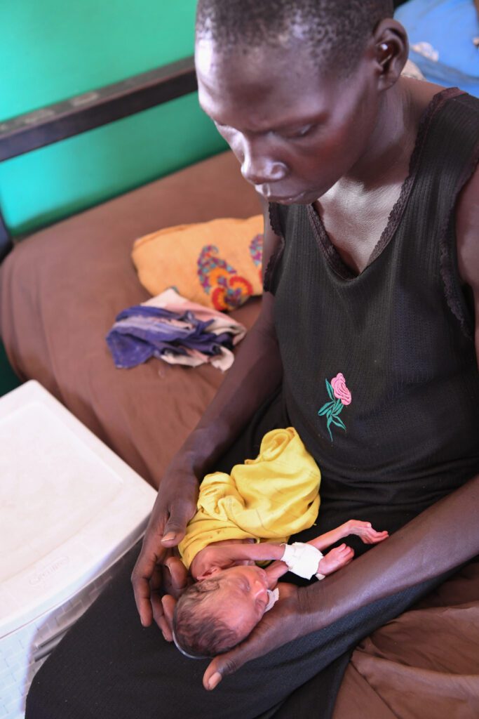 Baby Ngor only weighs 800 grams (credit: Jenny Davies)