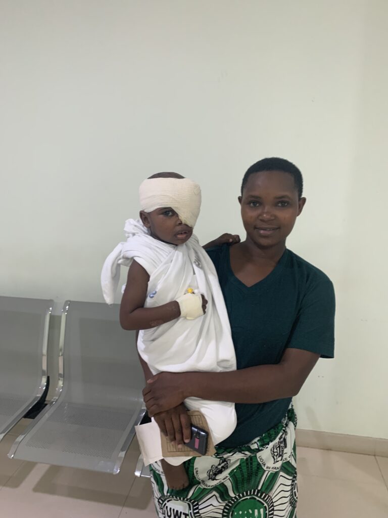 Neema after her first phase of surgery with her mother Juliana (credit: Dr Maher Anous)
