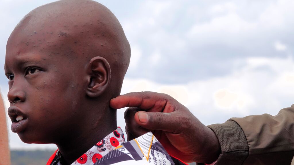 Samuel had a biopsy in Narok, which confirmed he had cancer (credit: Paula Alderblad)