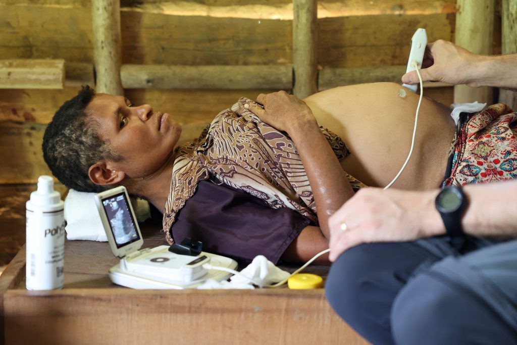 UNFPA: Only 56% of PNG women in labour are seen by a skilled health worker (credit: Annelie Edsmyr)