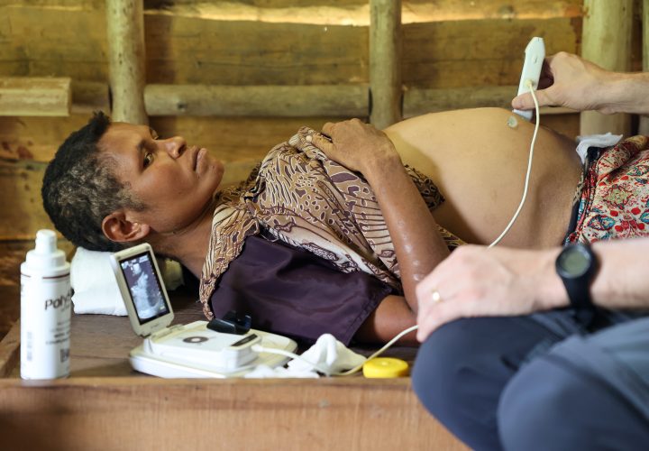 UNFPA: Only 56% of PNG women in labour are seen by a skilled health worker (credit: Annelie Edsmyr)