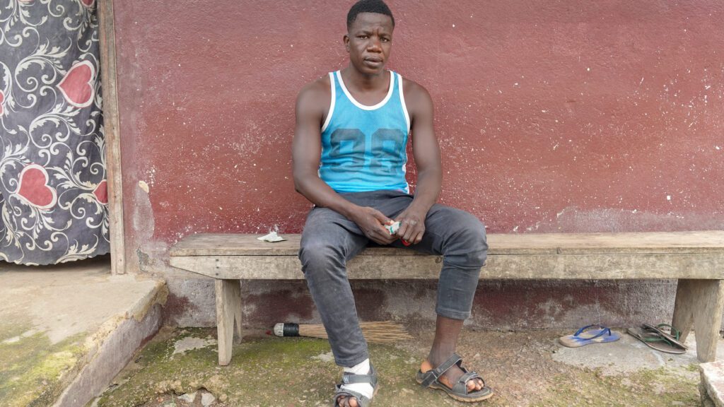 Norbert has been ostracised by family & friends because of leprosy (credit: Joel Conte)